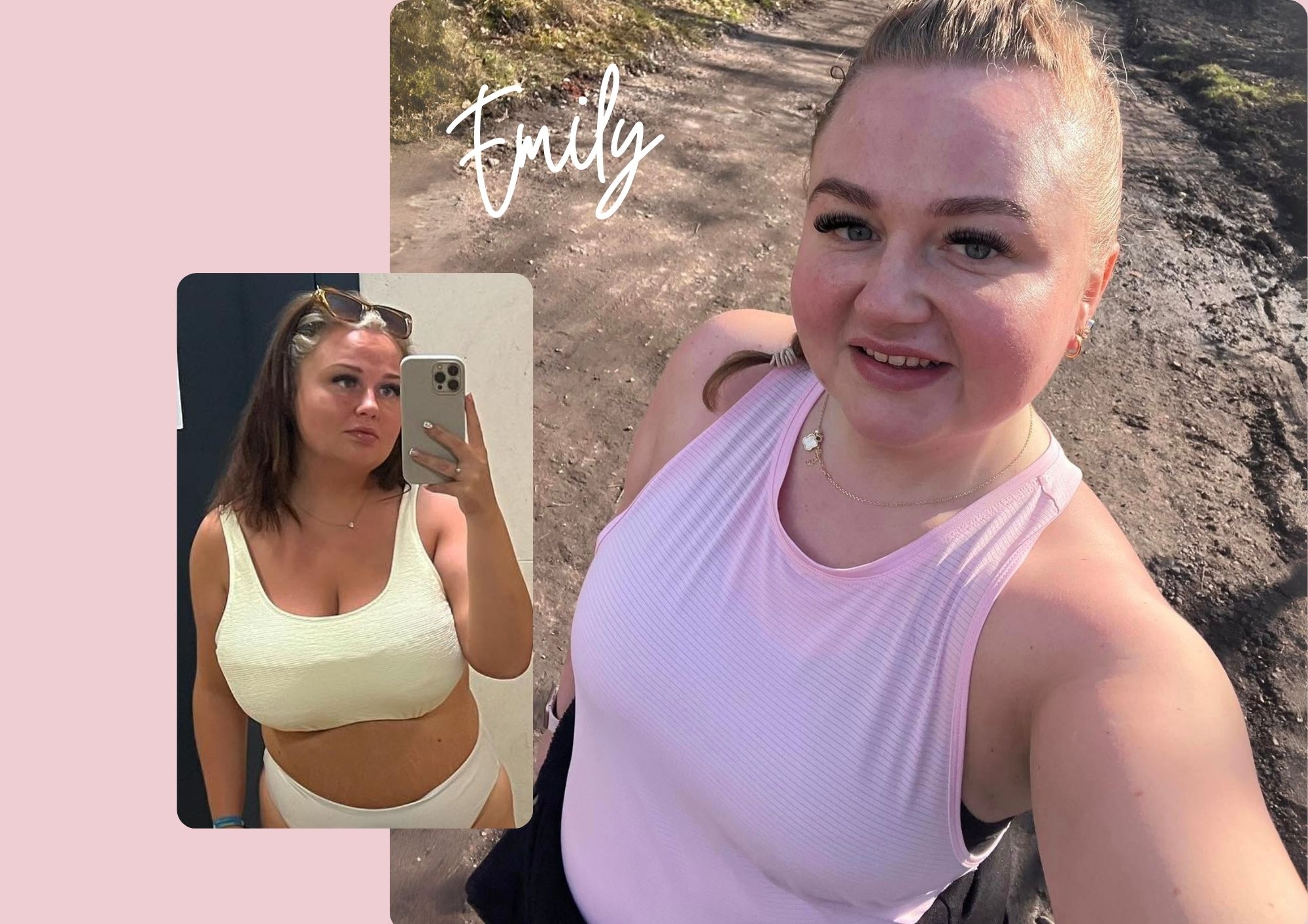Emily's Breast Reduction at Pall Mall Cosmetics Emily's Breast Reduction at Pall Mall Cosmetics
